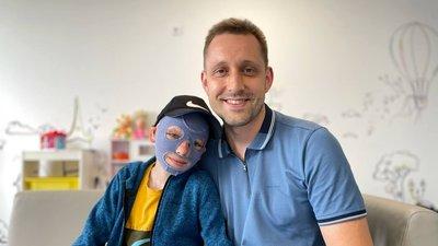 10-річному хлопчику, який постраждав під час ракетного удару по Вінниці, провели 36-ту операцію